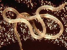 【寄生虫】唇の中を移動するミミズ、その時男は……!?