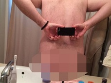 お尻の割れ目がない男!? 肛門が手前の方に…!!
