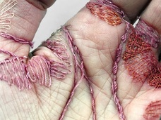 “人体刺繍”芸術が訴えかけるものとは? 英国人アーティストが挑戦する痛いアート