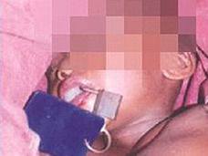父親に南京錠で口を塞がれ、焼かれた4歳の少年 「悪魔の子」と呼ばれて=ナイジェリアが抱える闇