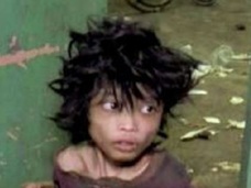 育児放棄で監禁された15歳の少年!! 痛まし過ぎる姿が児童虐待の実態を訴える