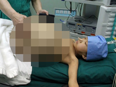 “内臓を押し潰すほどの”超巨大腫瘍を切除!! 膨らみ続ける腹部に耐えた少女=中国