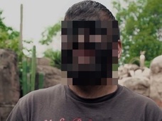 実在する狼男の苦悩 ― 「先天性多毛症」に悩む患者の現実に、心が痛くなる!!