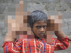 「育ちすぎる巨大な手」を持つ8歳の少年 ― 膨張が止まらぬ謎の症状に医師も困惑=インド