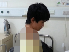 【人体の不思議】長すぎる首を持つ少年 ― “アレの数”が3個も多かった!!=中国