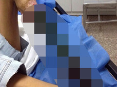 【閲覧注意】毒ヘビに噛まれた少女の壊死した脚がヤバい!! 医師「切断しても死ぬかもしれない」