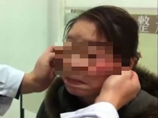 老婆にしか見えない28歳 ― 首から上だけ若さと美貌を奪う、残酷な病