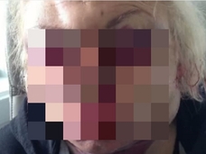 1秒ごとに顔が風船のように膨らみ続けて、頭部が2倍に! 性転換整形手術=イギリス