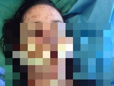 【警告】他人事ではない? 薬の副作用で美少女の姿が変わり果てる悲劇!!