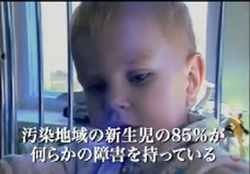 『チェルノブイリ・ハート』 他人事ではない汚染地域の子どもたちの驚愕の実態