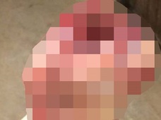【閲覧注意】また“人面ブタ”が誕生…! 続発する“額からペニス”現象!