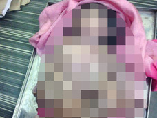 【閲覧注意】手足が4本ずつの赤ん坊が誕生!! 「神の姿をひと目拝みたい」群衆が押しかけ大騒動=インド