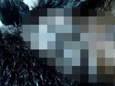 【閲覧注意】すべての恐怖は、毛穴にある ー 見たら必ず鳥肌が立つ「ボットフライ」映像