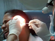 【閲覧注意】耳の中の悪趣味でおぞましすぎる快楽 ― モダン・フリークスが選ぶ「ear wax」グロ映像5選