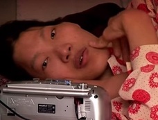 中国の巨人症の女 ― 貧困と悲運が引き起こした悲しい死