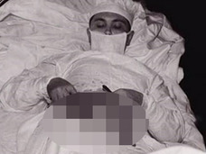 自らの腹部を切開した男 ― 極限状態で決死の手術=旧ソ連