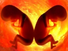 【驚愕】女性が双子を妊娠→父親がそれぞれ別の男だった!! 「異父過妊娠」という奇跡
