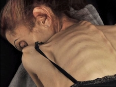 【拒食症】身長170cm体重18キロ ― 米国人女優を「死のダイエット」に駆り立てたものとは?