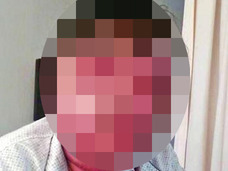【衝撃】蚊に刺されすぎて顔面崩壊した男!! 見るも無残な風船顔に……=中国