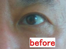 【衝撃変身】脂ギッシュな中年男が1カ月で「人形肌」に!? 最強の若返り成分「NMN」を試してみた!