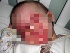 「ママ、僕はもう死にたい」5歳児がこうまで訴える難病「FSGS」の絶望的病状とは!?