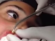 【閲覧注意】少女の唇から頭をのぞかすウジ虫!! キモすぎて身震いする寄生虫動画5選!