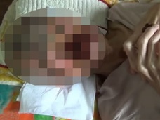 【超・閲覧注意】顔面ドロドロ陥没穴の男 ― 想像を超える悪夢と、神領域の生命力