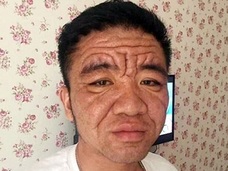30歳なのに80歳の容姿! 男が突然“超老け顔”になった謎の症状が怖すぎる!!=中国