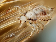 【閲覧注意】背筋がゾゾーッ!! 凄まじい繁殖力でシラミが湧いた「ウヨウヨ頭」