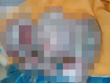 【超・閲覧注意】生まれた我が子の姿を見て絶望 ― 奇病「ハーレクイン型魚鱗癬」の赤ん坊映像に衝撃