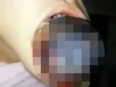 【閲覧注意】舌ガンを放置した男の口元がグロすぎる! ドス黒い塊、ドロドロ流血…!!