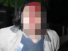 【閲覧注意】こんな自殺は見たことない! 一心不乱にヘドバンして頭を割った男!!=ルーマニア
