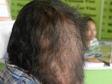 【閲覧注意】頭から巨大スライムが垂れる男 ― 次世代エレファントマンの苦しい人生に一筋の光が差した!=カンボジア