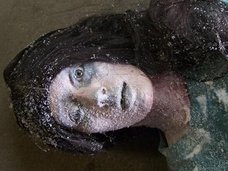 【閲覧注意】凍死後50日で蘇生した女、凍傷でミイラ化する体…! 寒さによる究極の人体被害