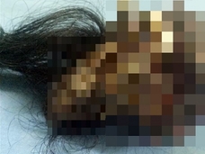 【閲覧注意】男の腹の中から“毛むくじゃらの人間”が出現=インド