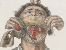 【閲覧注意】19世紀の野蛮な外科手術が怖すぎる、痛すぎる、残酷すぎる!