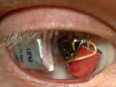 自分の眼球をビデオカメラにした男 ― 自称・アイボーグが見る世界とは?=カナダ