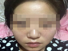 「韓国で整形するとヘビ女になる!?」中国“美容整形難民”たちが、今度は日本へ?
