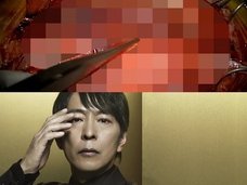 【閲覧注意】徳永英明も受けた「もやもや病」の手術映像がグロすぎてヤバい!