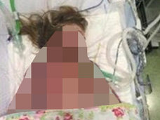 【閲覧注意】肌の内側から血が噴き出すような炎症…! 「髄膜炎」で死んだ少女の写真を公開した両親の願いとは?