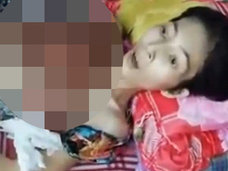 【超・閲覧注意】胸一面に“肉片の花”が咲いた女 ― 凄まじい状況の中、彼女は何かを言おうとしていた…