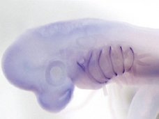 【衝撃】人間の手足は“魚のエラ”から進化した!? 「ソニック・ヘッジホッグ遺伝子」で判明(最新研究)