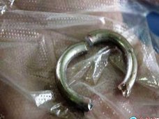 中国人男性は「金属リング自慰行為」がお好き? 抜けなくなって、あわや陰茎壊死!