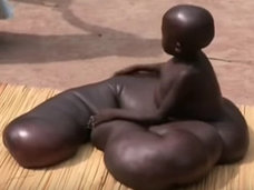 【閲覧注意】とぐろを巻く少年 ― 医師も見放すほどの激烈な「壊死性筋膜炎」=ウガンダ