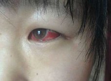 粗悪建材が原因で児童がシックハウスに集団疾患! 中国で急増する「毒学校」による健康被害