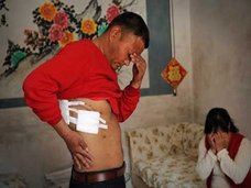 執刀医はブローカーだった!? 病院で手術を受けた患者の右腎臓が行方不明に!