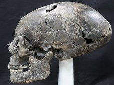 韓国で新羅時代の「コーンヘッド」頭蓋骨が発掘され衝撃広がる! 日本人の遺骨の可能性も…!?