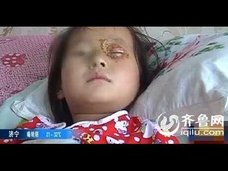【チャイナボカン】今度は誕生日ケーキが爆発! 女児の角膜直撃で失明の危機に……