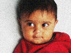 1歳の赤ん坊のペニスが突然、25歳に急成長! 陰毛生えて“大人の股間”に=インド