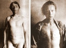 麻酔なしで信者全員去勢、乳首と女性器も切除 ― ロシア、恐るべき異端の宗教「スコプツィ」とは?